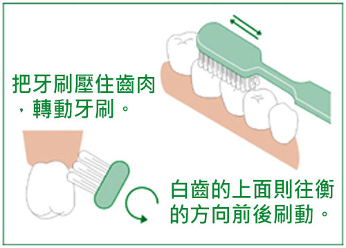 蛀牙和正確刷牙方法