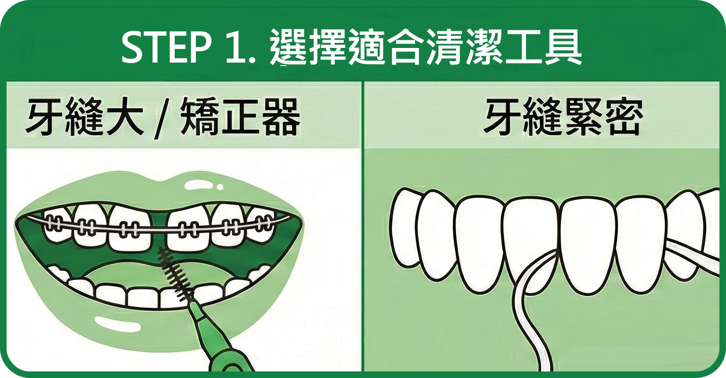 牙縫清潔工具選擇